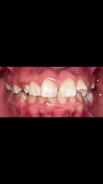 Clinica Dental Salazar Quitumbe