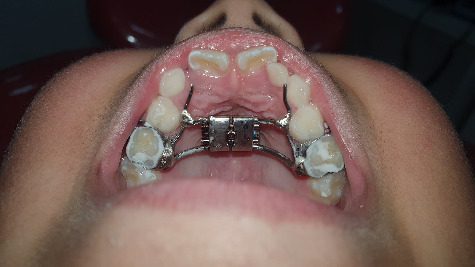 Clinica Dental Salazar Quitumbe